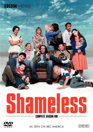 Shameless- Die Serie